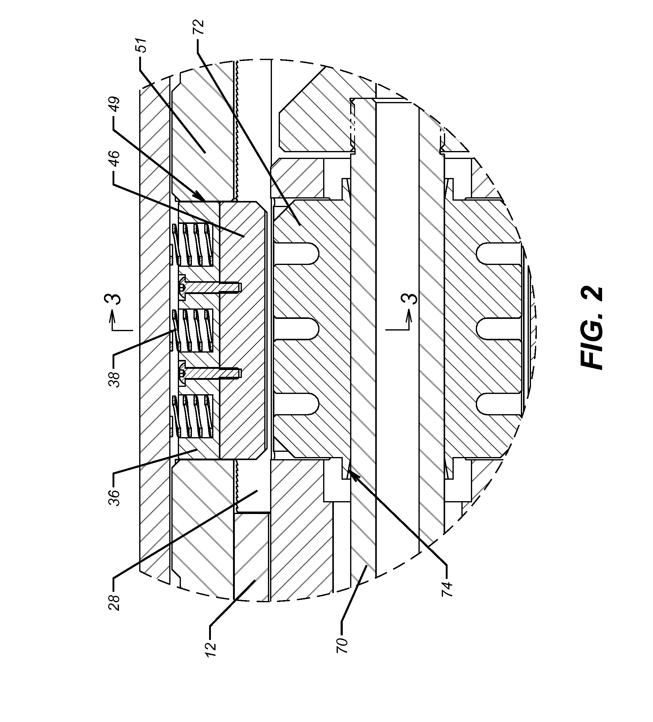 Radially Expandable Ratcheting Body Lock Ring for Production Packer Release