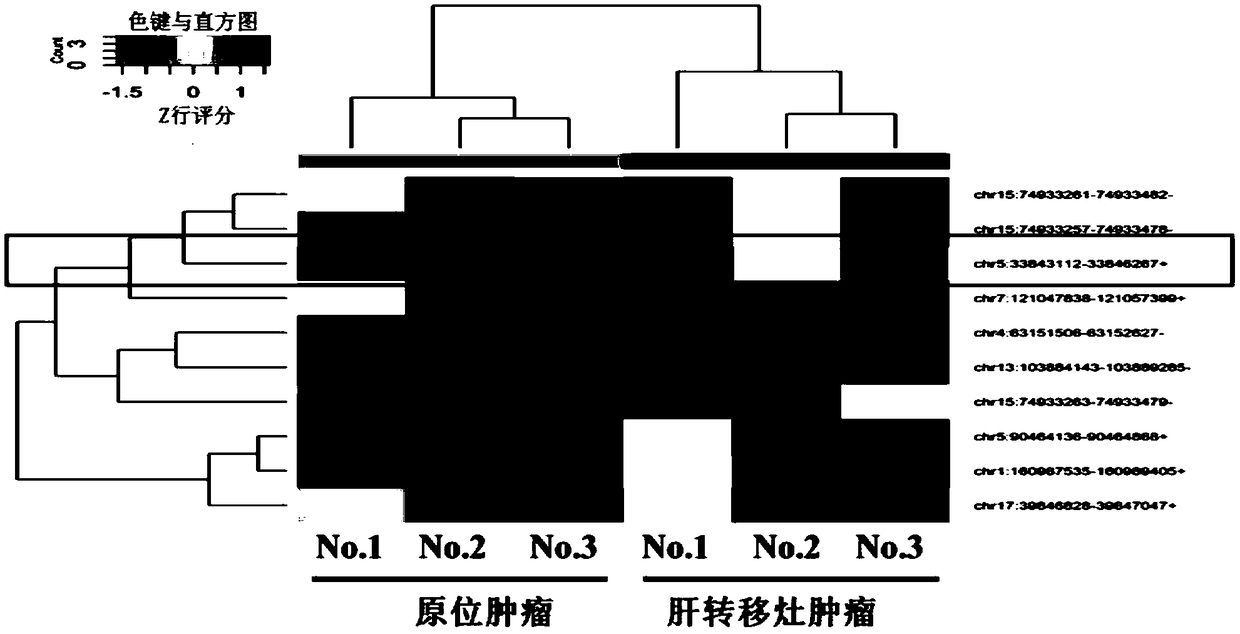 Circ-WHSC1 serving as colorectal cancer diagnostic marker and application thereof