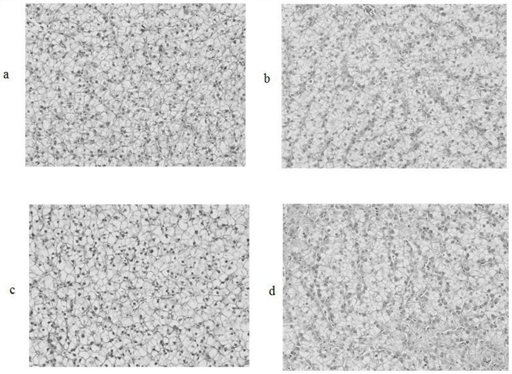 Feed additive for relieving hepatic glycogen accumulation and application thereof