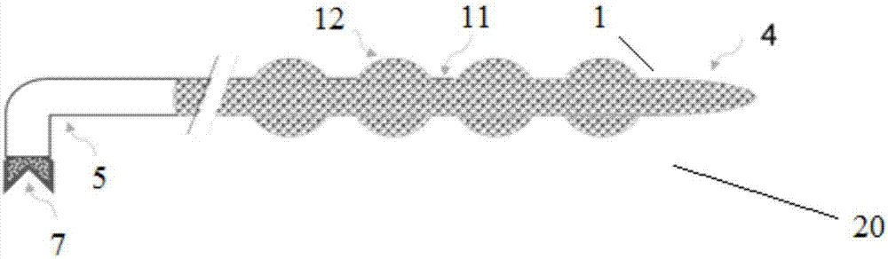 In-vivo enrichment device for circulating tumor cells