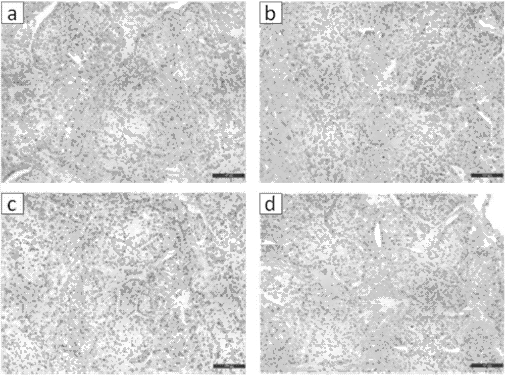 Tumor tissue in-vitro preservation liquid and preparation method thereof