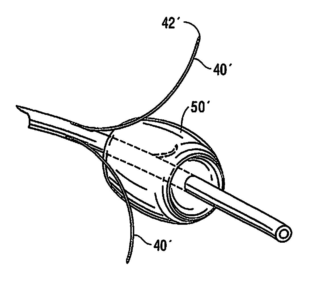 Apparatus for delivering fluid to treat renal hypertension