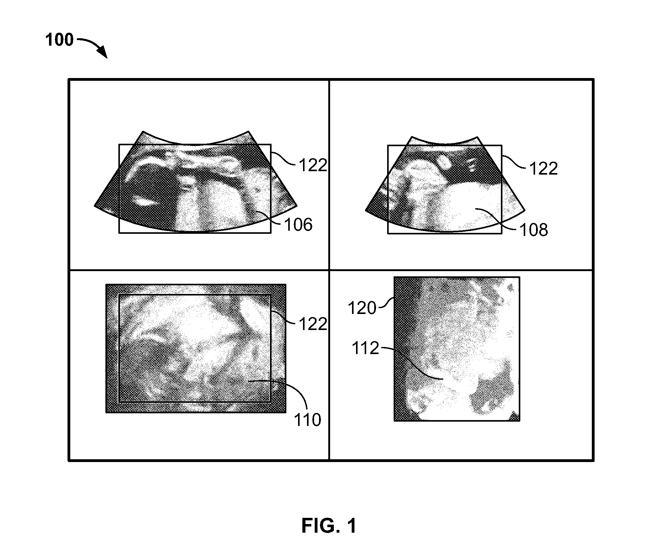 Methods and systems for removing occlusions in 3D ultrasound images