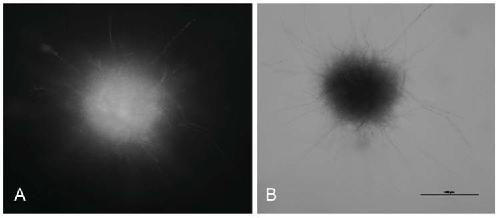 Genetic Transformation Method of Agrobacterium Tumefaciens Mediated by Agrobacterium tumefaciens