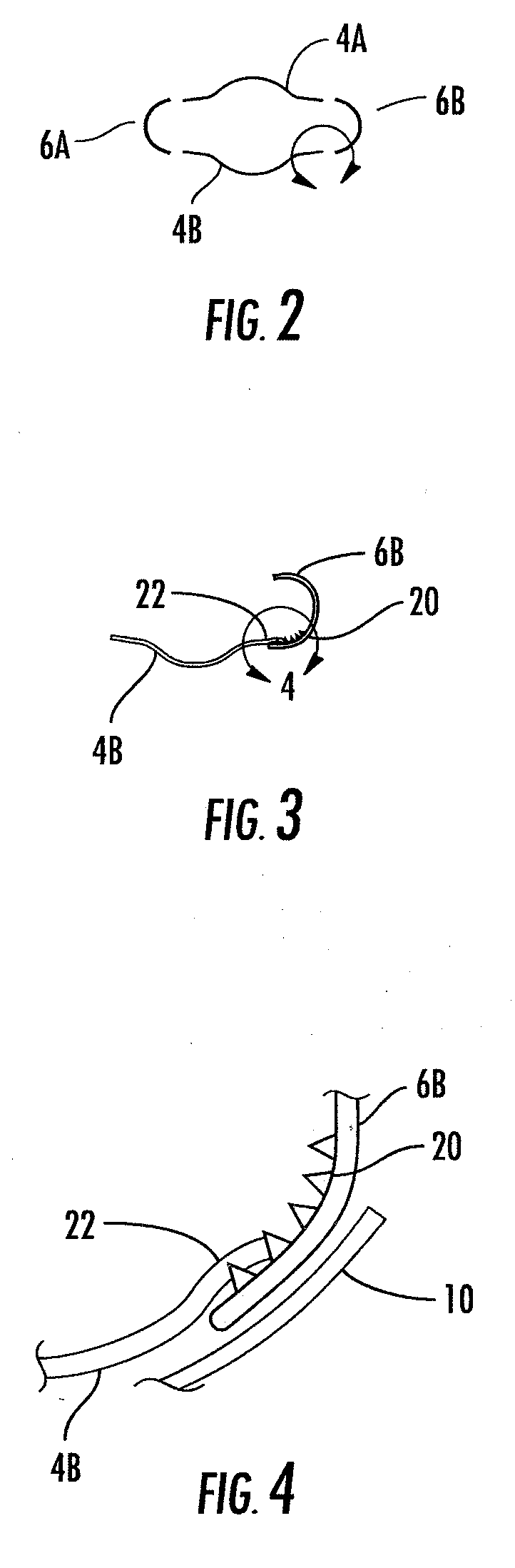 Retractor and mounting pad