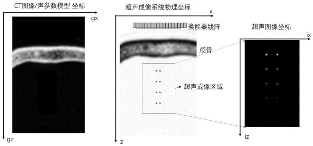 Correction method for plane ultrasonic transcraniocerebral imaging