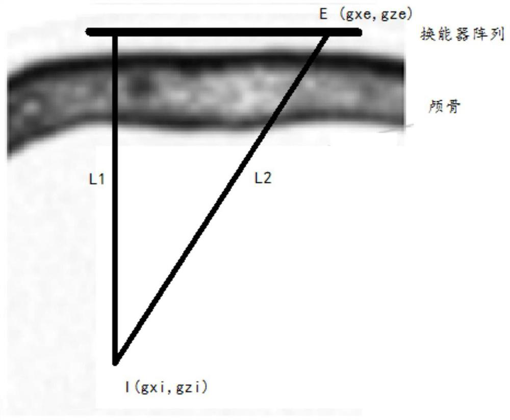 Correction method for plane ultrasonic transcraniocerebral imaging