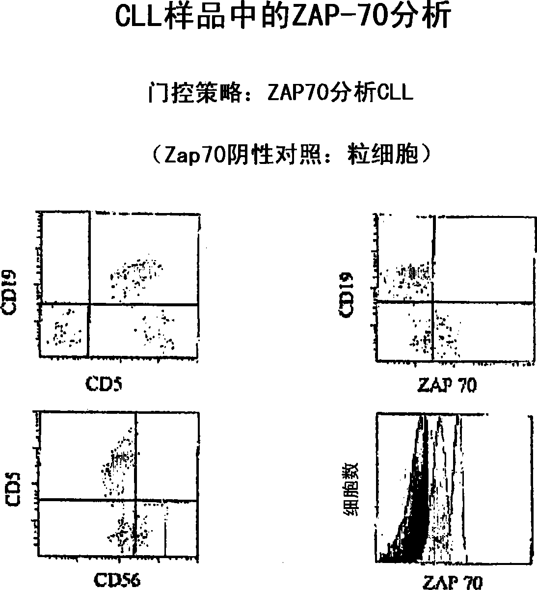 Composite profiles of cell antigens and target signal transduction proteins for analysis and clinical management of hematologic cancers