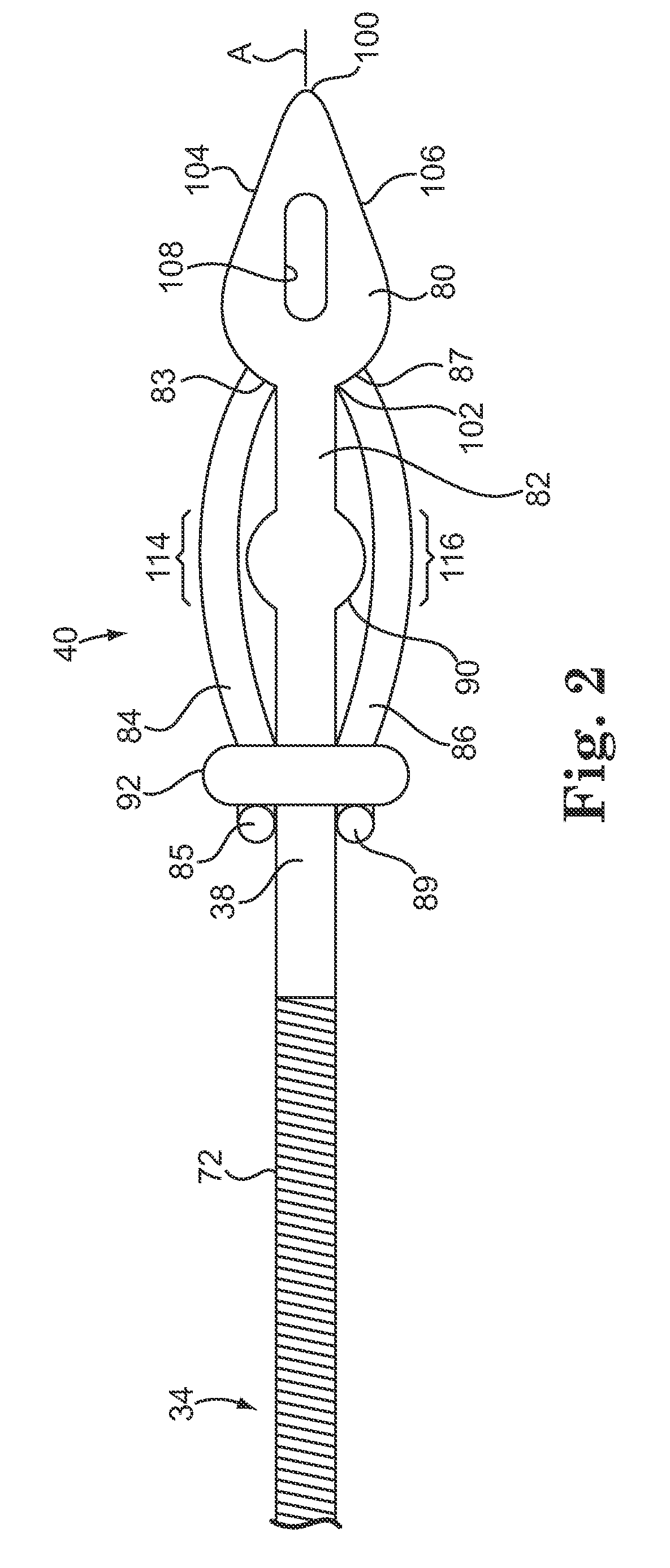 Subcutaneously implantable lead including distal fixation mechanism