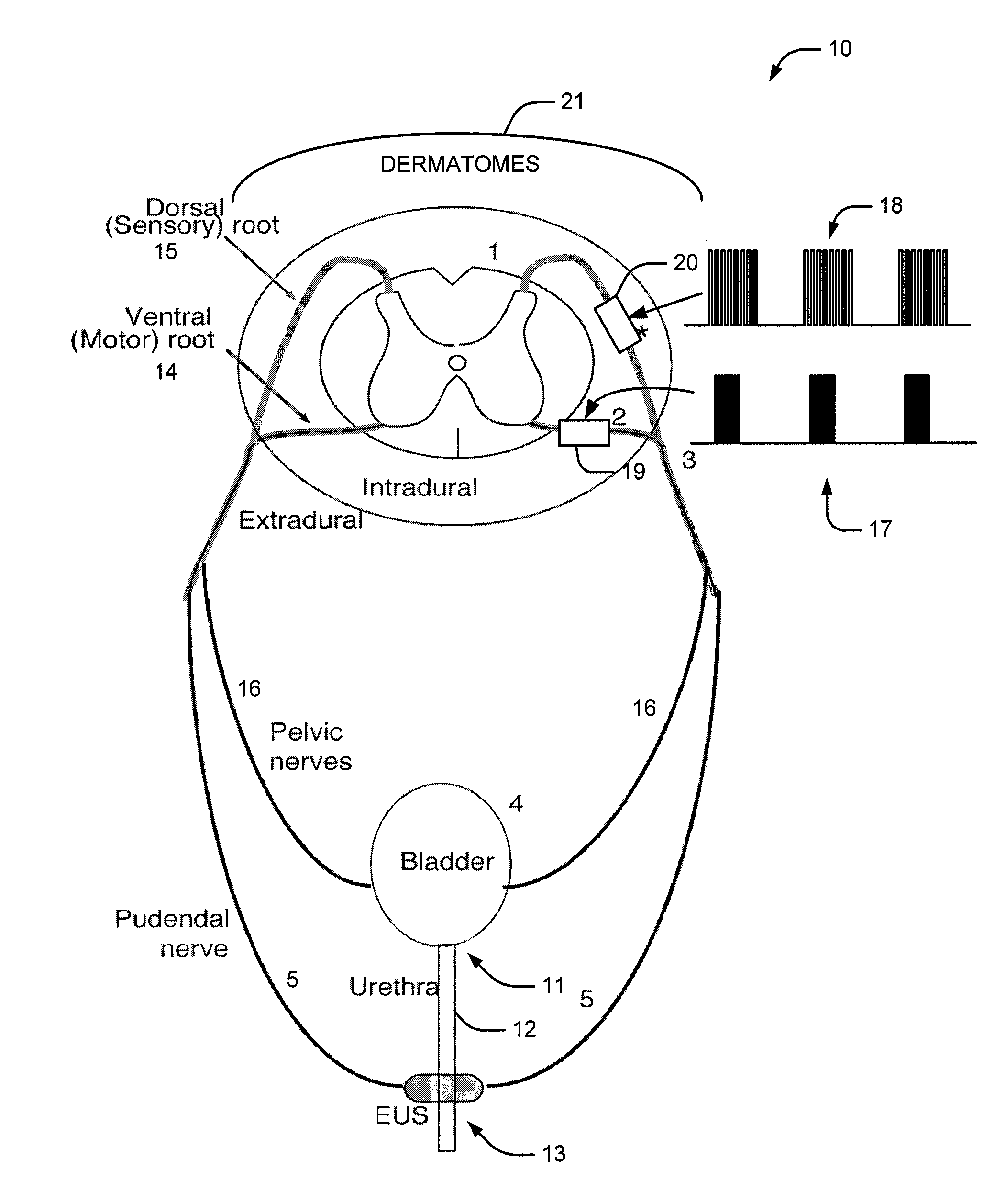 System and method of bladder and sphincter control