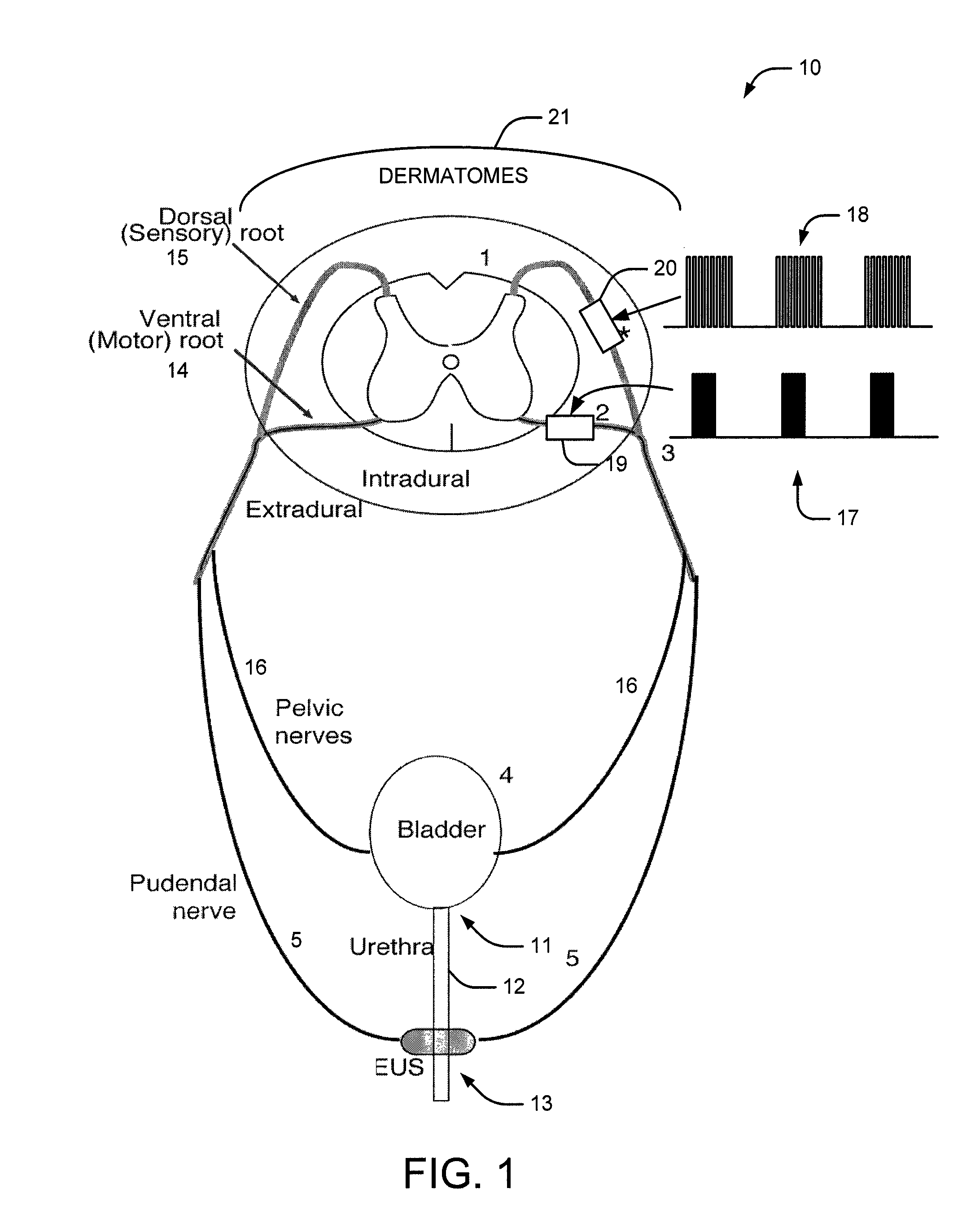 System and method of bladder and sphincter control