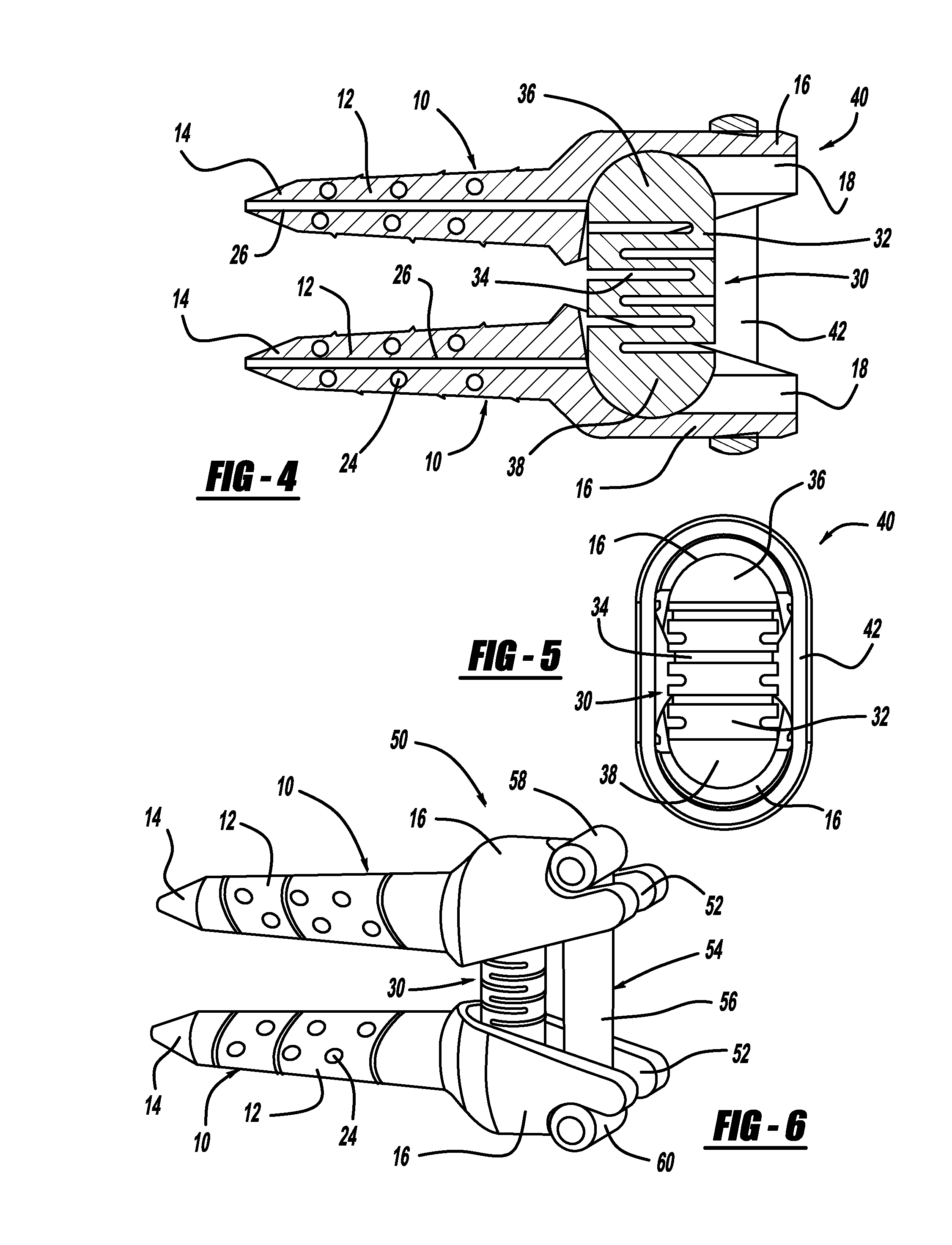 Vertebral disc tensioning device