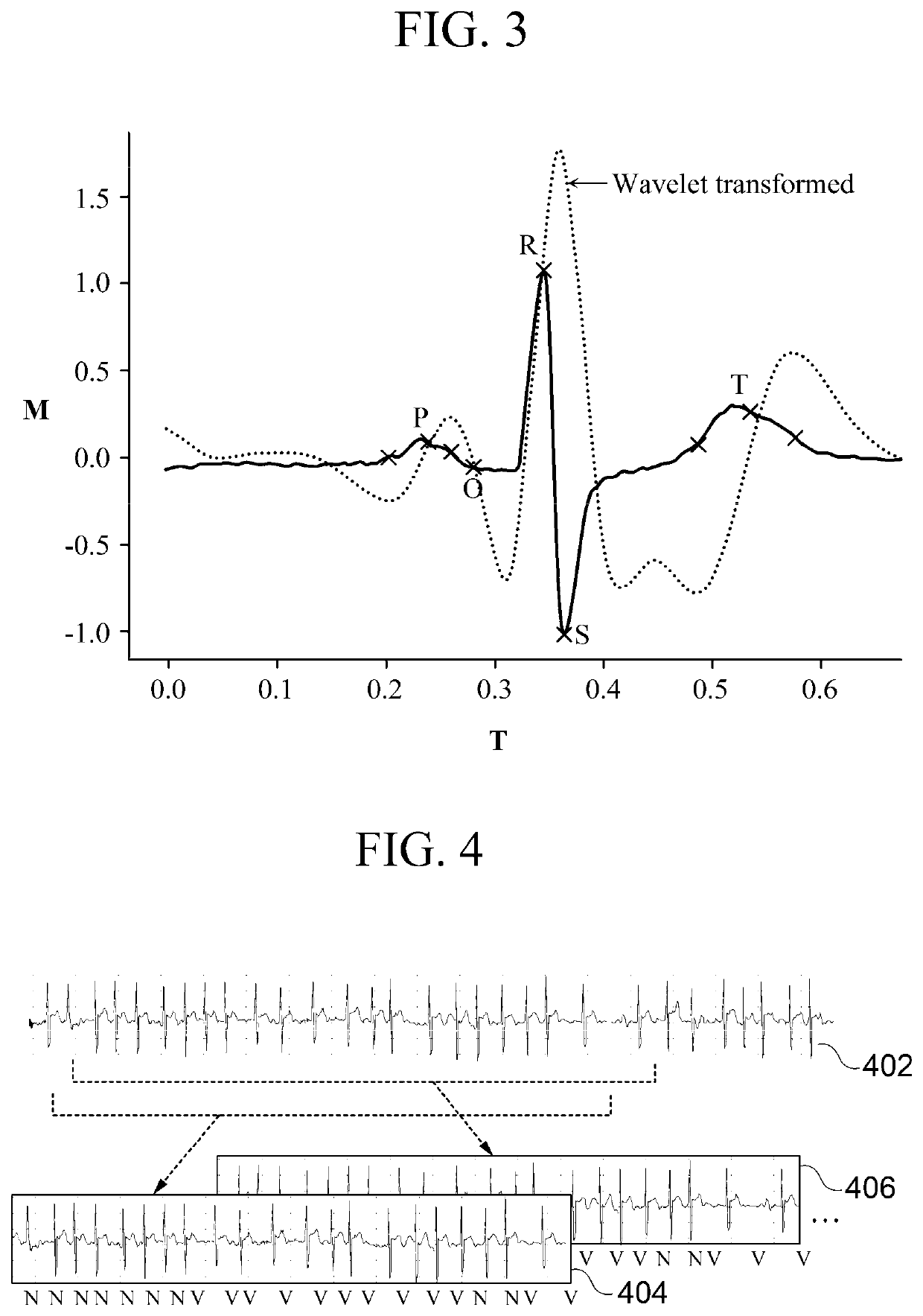 Apparatus and method for analyzing electrocardiogram