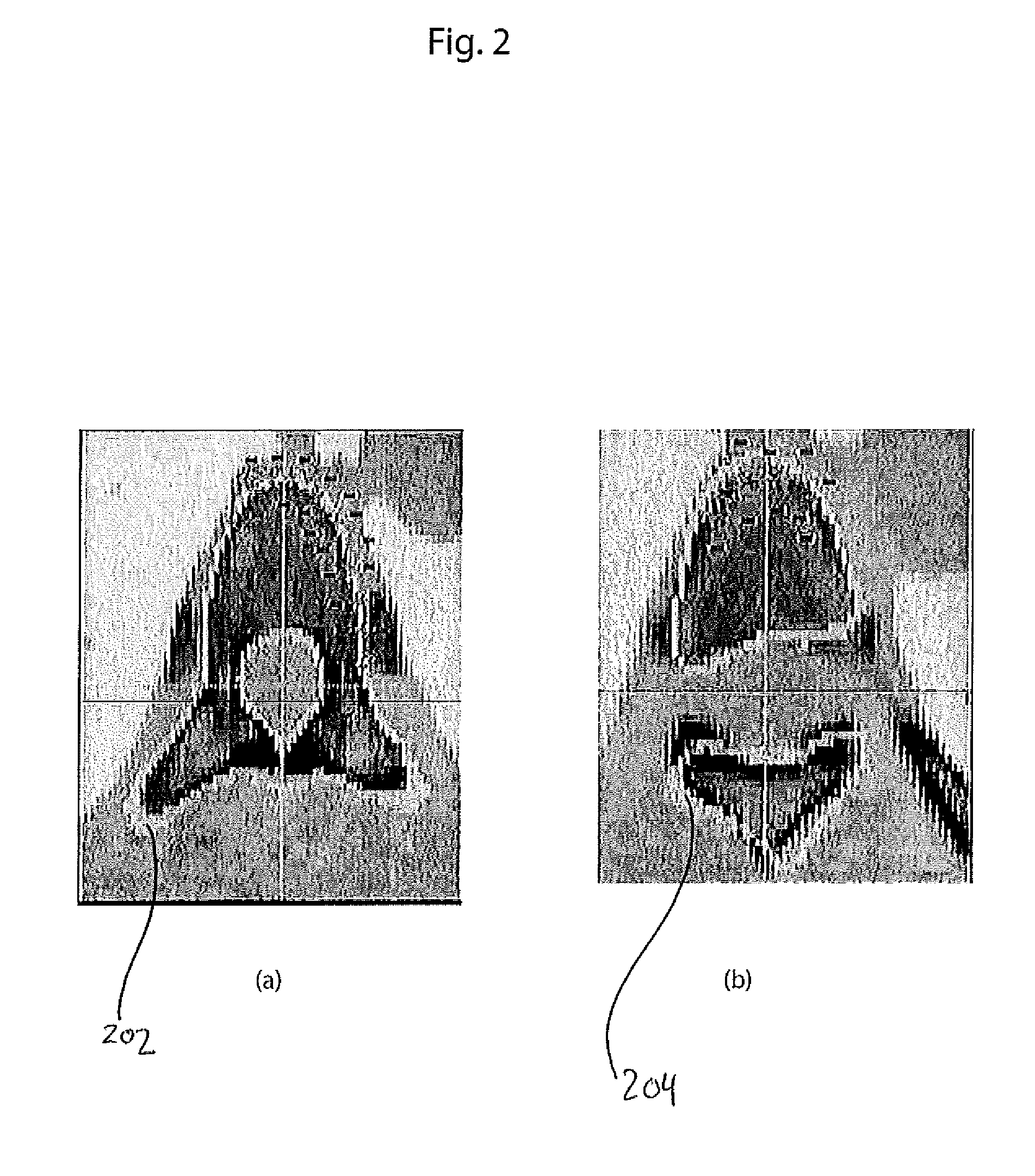 Systems and methods for automatic vertebra edge detection, segmentation and identification in 3D imaging