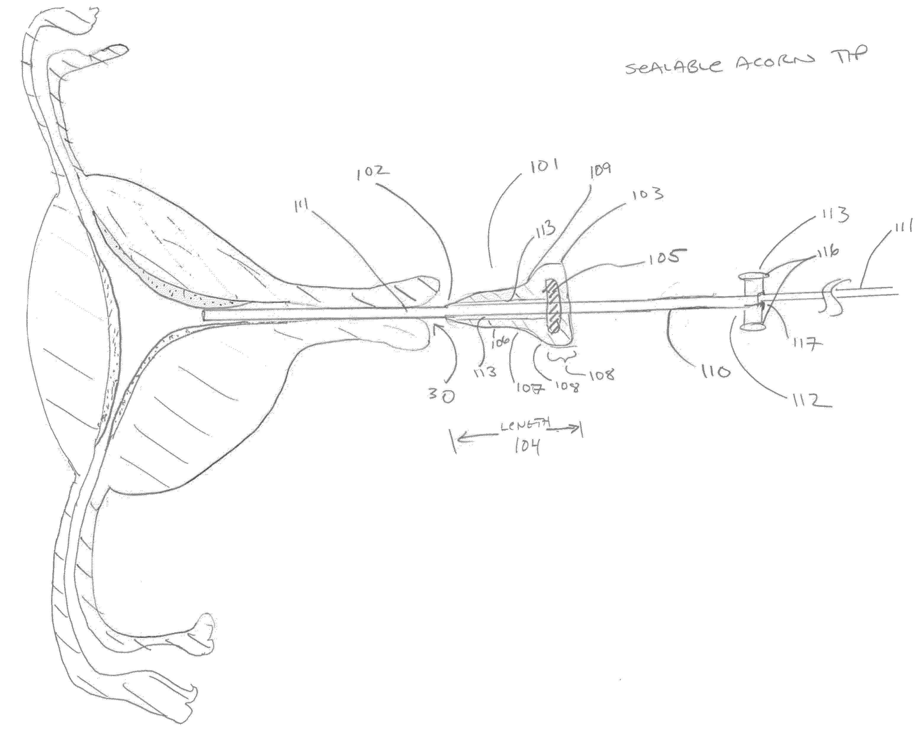 Biopsy and sonography method and apparatus for assessing bodily cavities