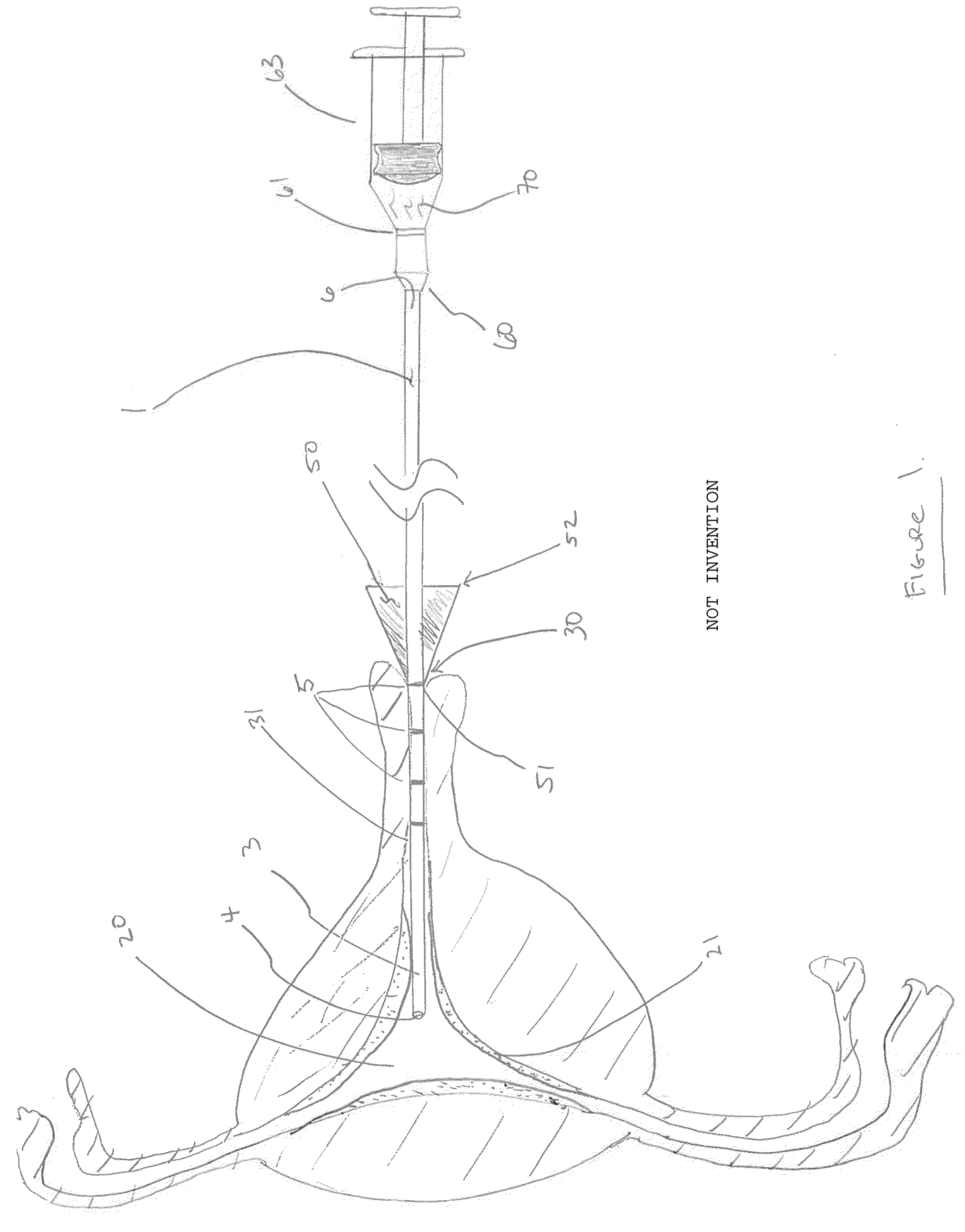 Biopsy and sonography method and apparatus for assessing bodily cavities