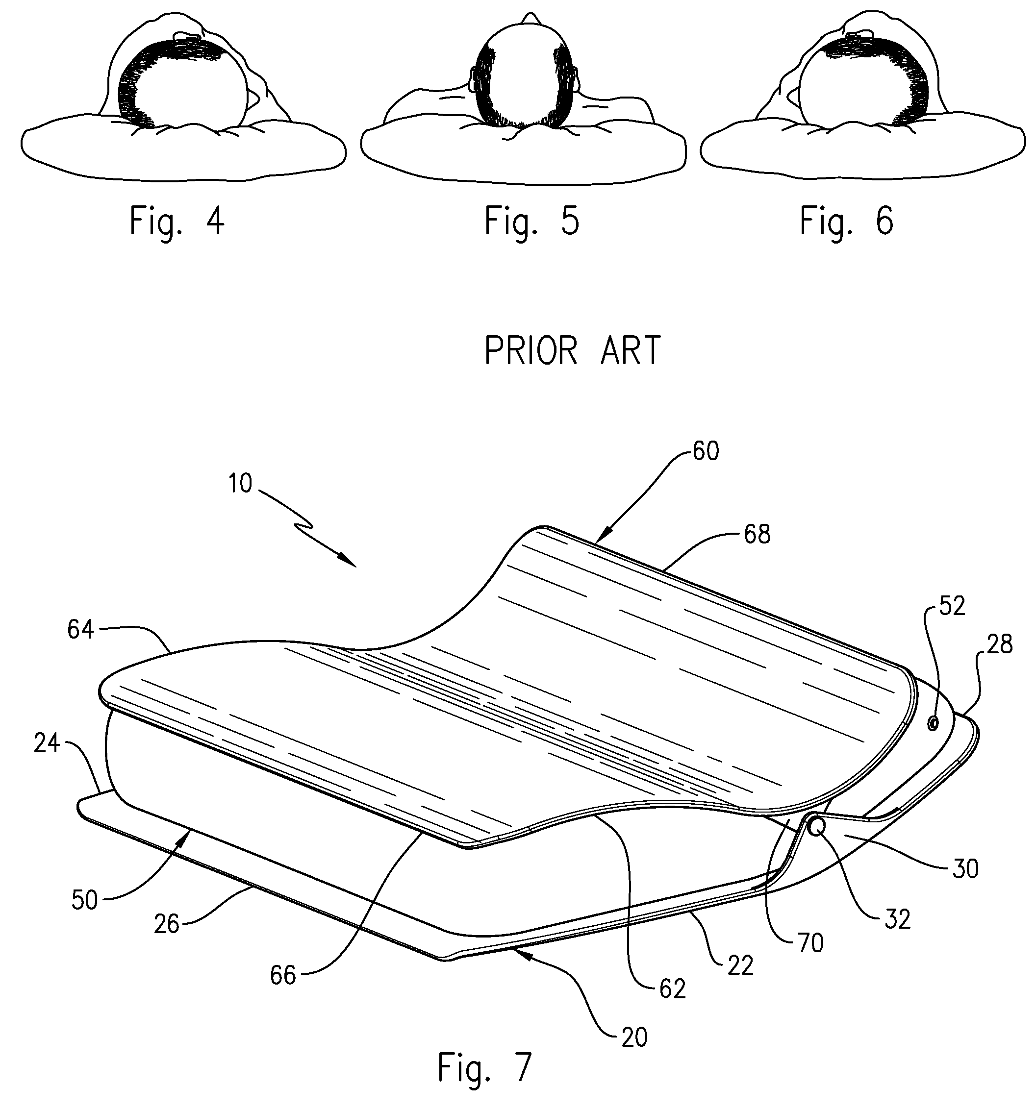 Method with apparatus to prevent baldness and stimulate hair growth