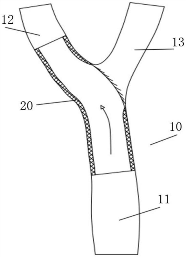 Covered stent