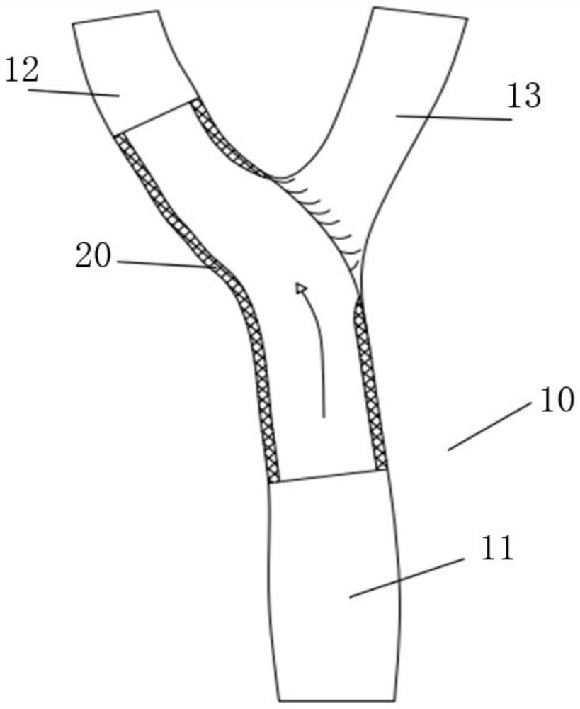 Covered stent