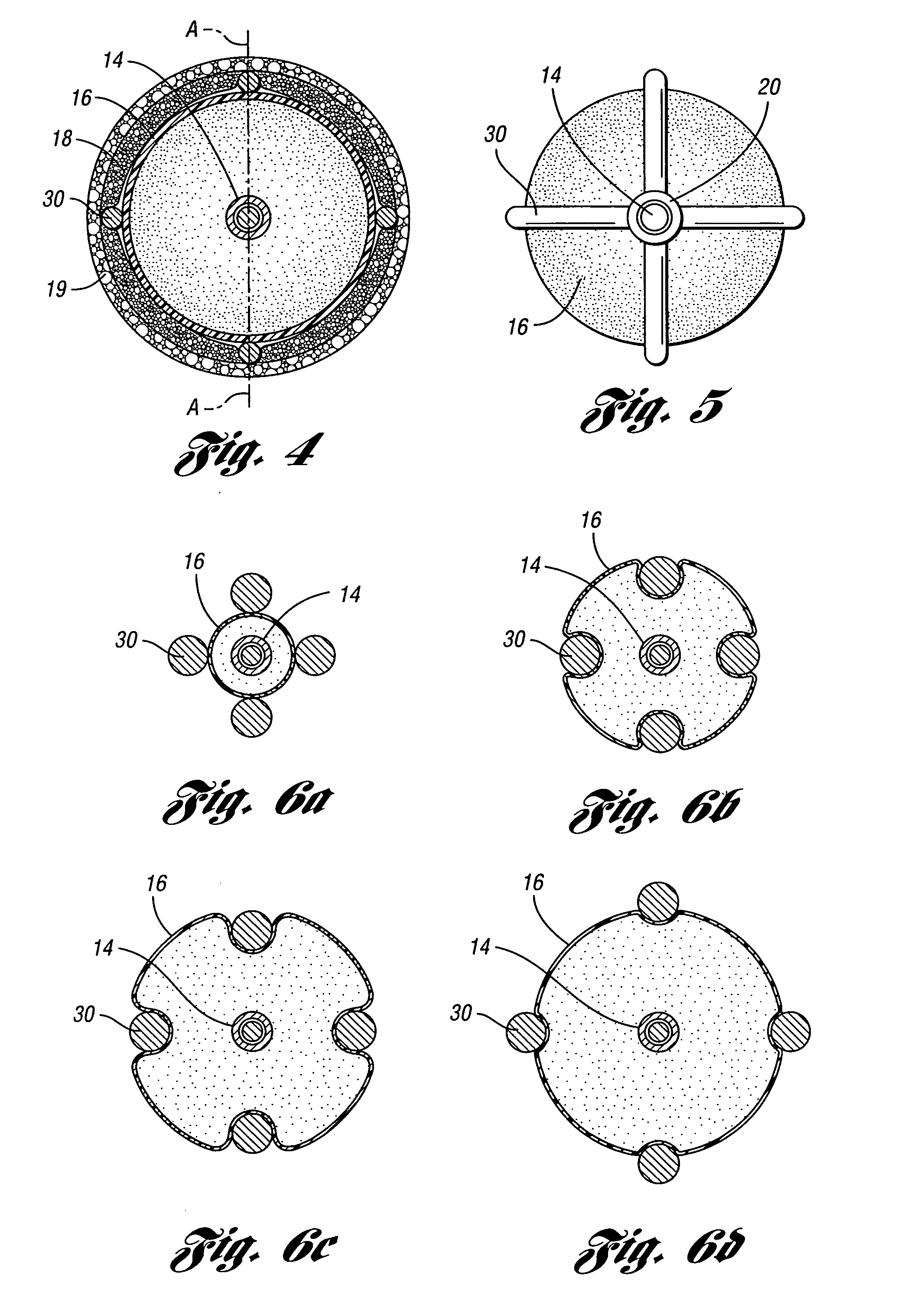 Angioplasty cutting device and method for treating a stenotic lesion in a body vessel