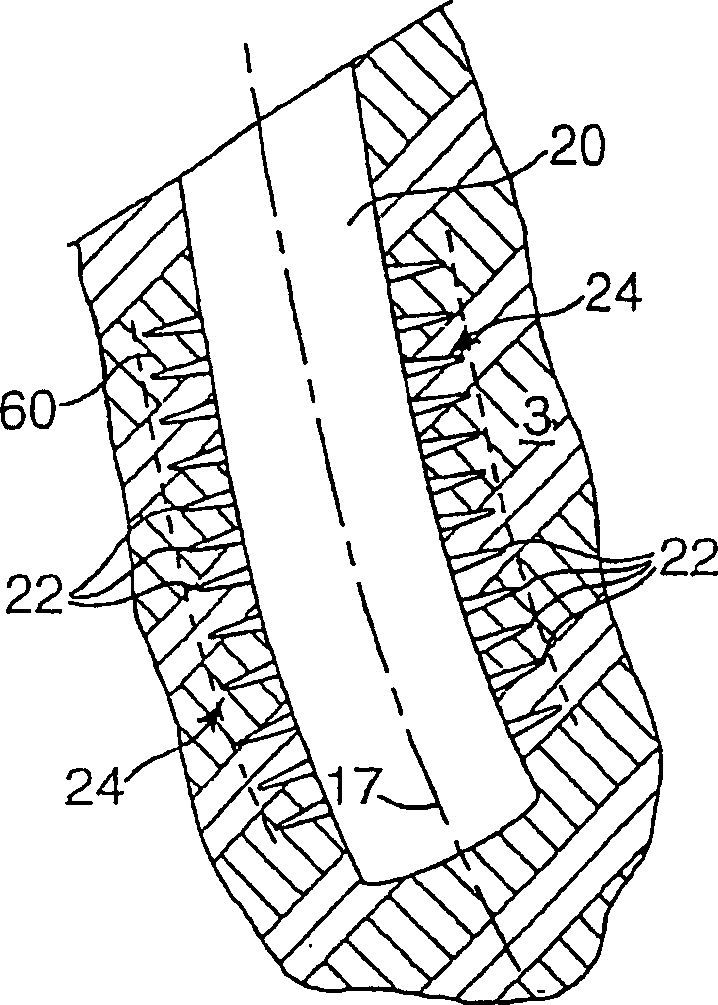 Method of reducing sand production from a wellbore