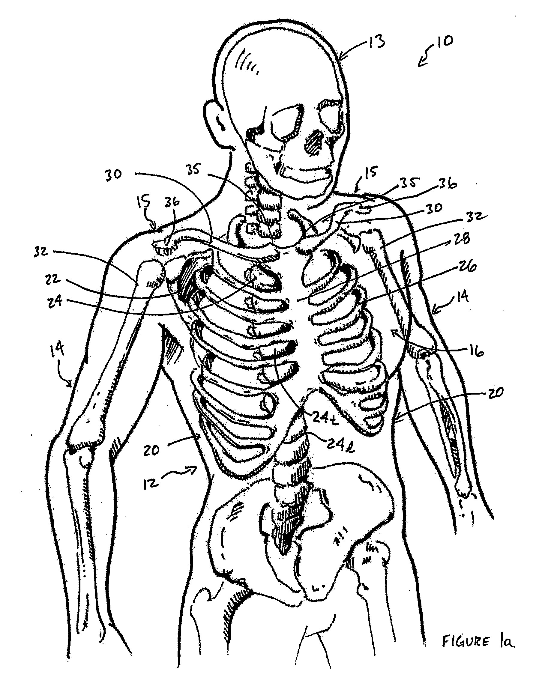 Posture Support Device