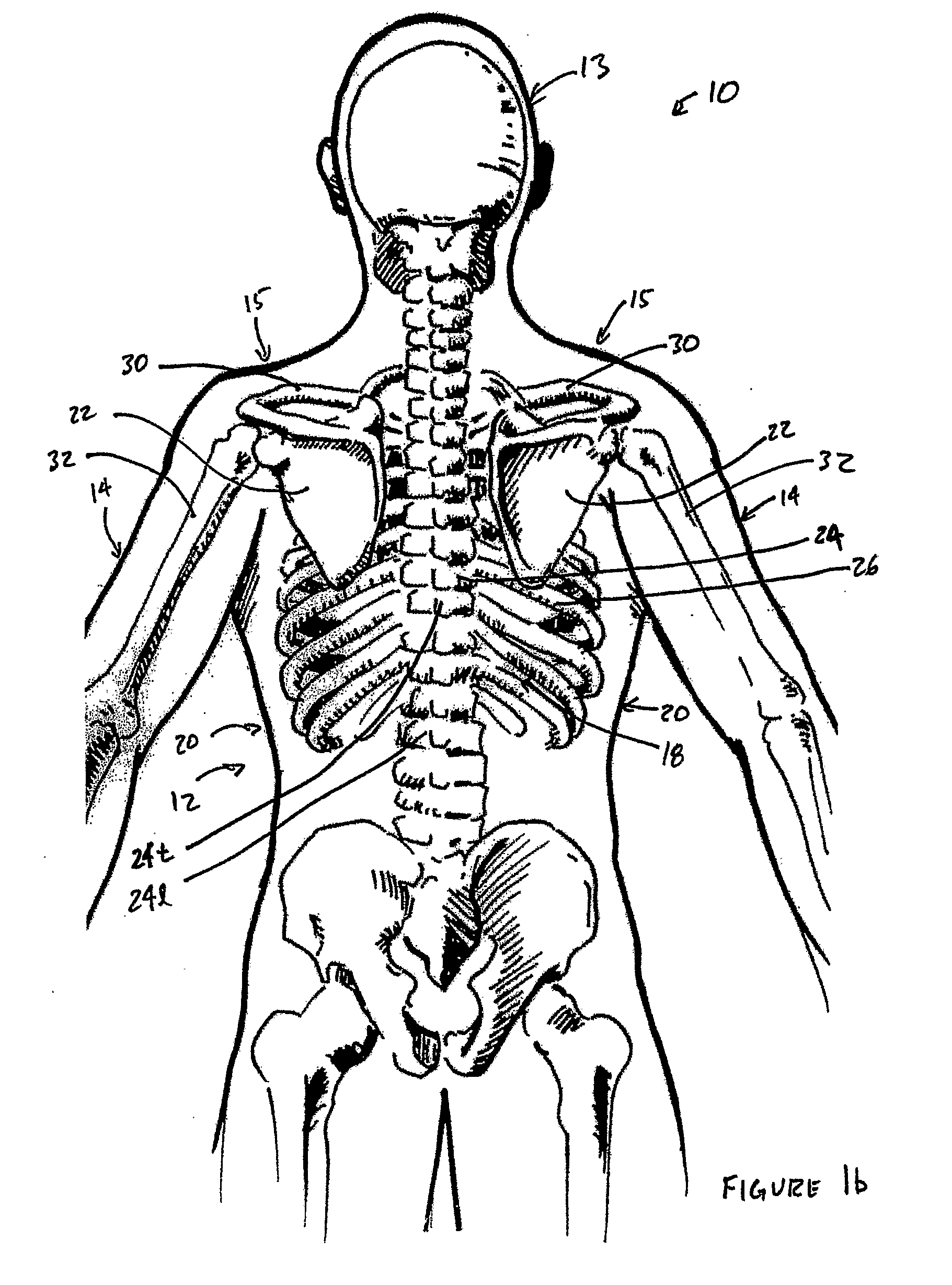 Posture Support Device