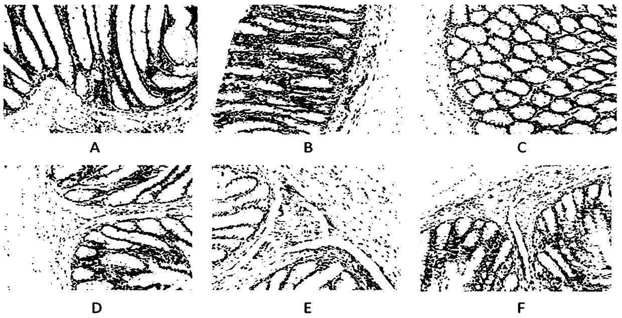 Modeling method for irritable bowel syndrome