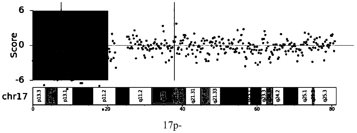 Application of chromosome instable mutation to preparing agent or kit for diagnosis, evaluation and prognosis of multiple myeloma