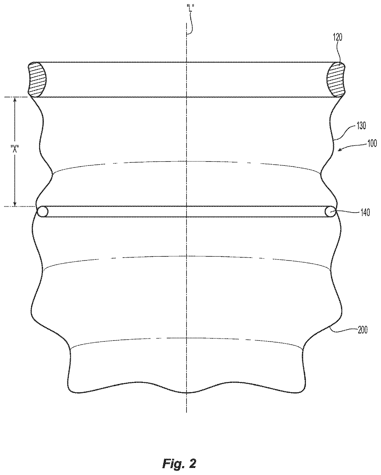 Cutting guard with radiofrequency dissection