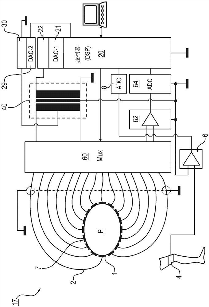 Device and method for determining regional compliance of lungs