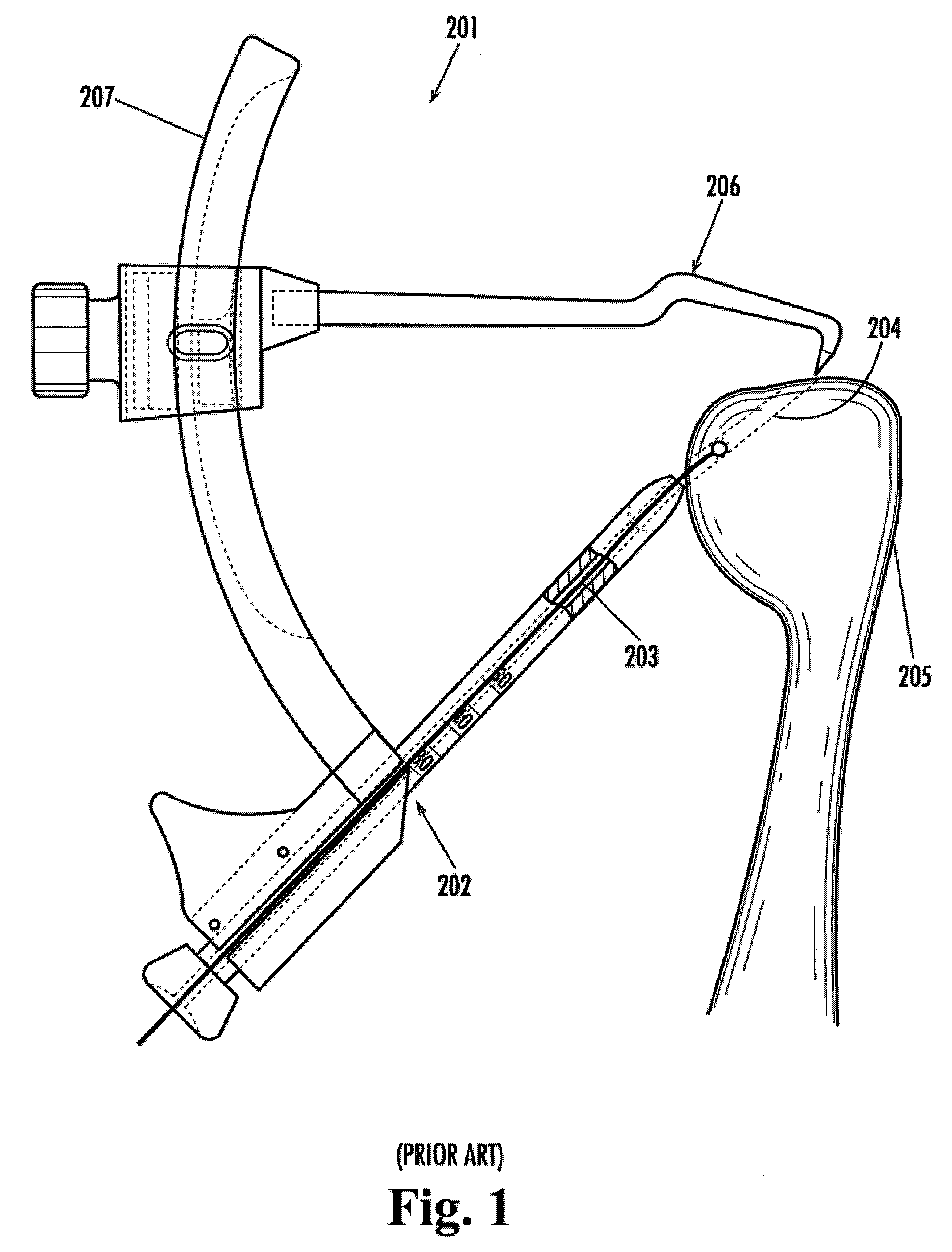 Suture anchoring system and method