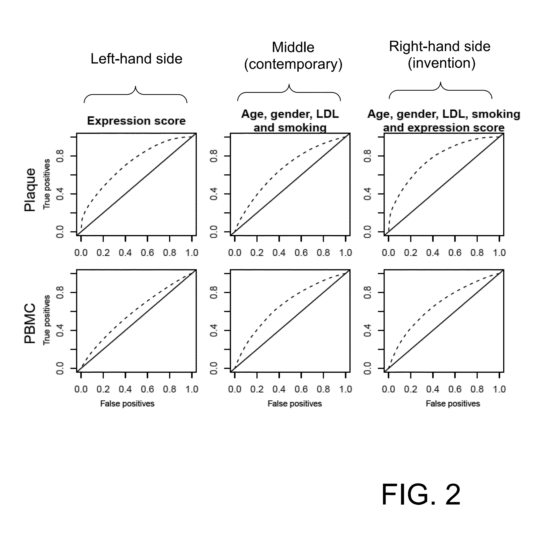 Method and Kit for Performing Profiling of Endarterectomy Patients