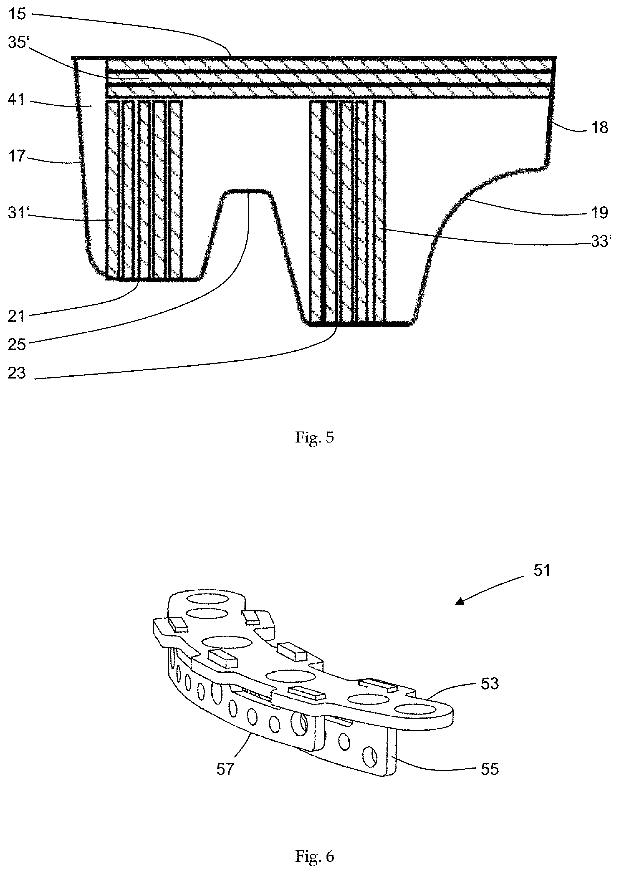 Shoeing made of a fiber-plastic composite, in particular for horses or racehorses