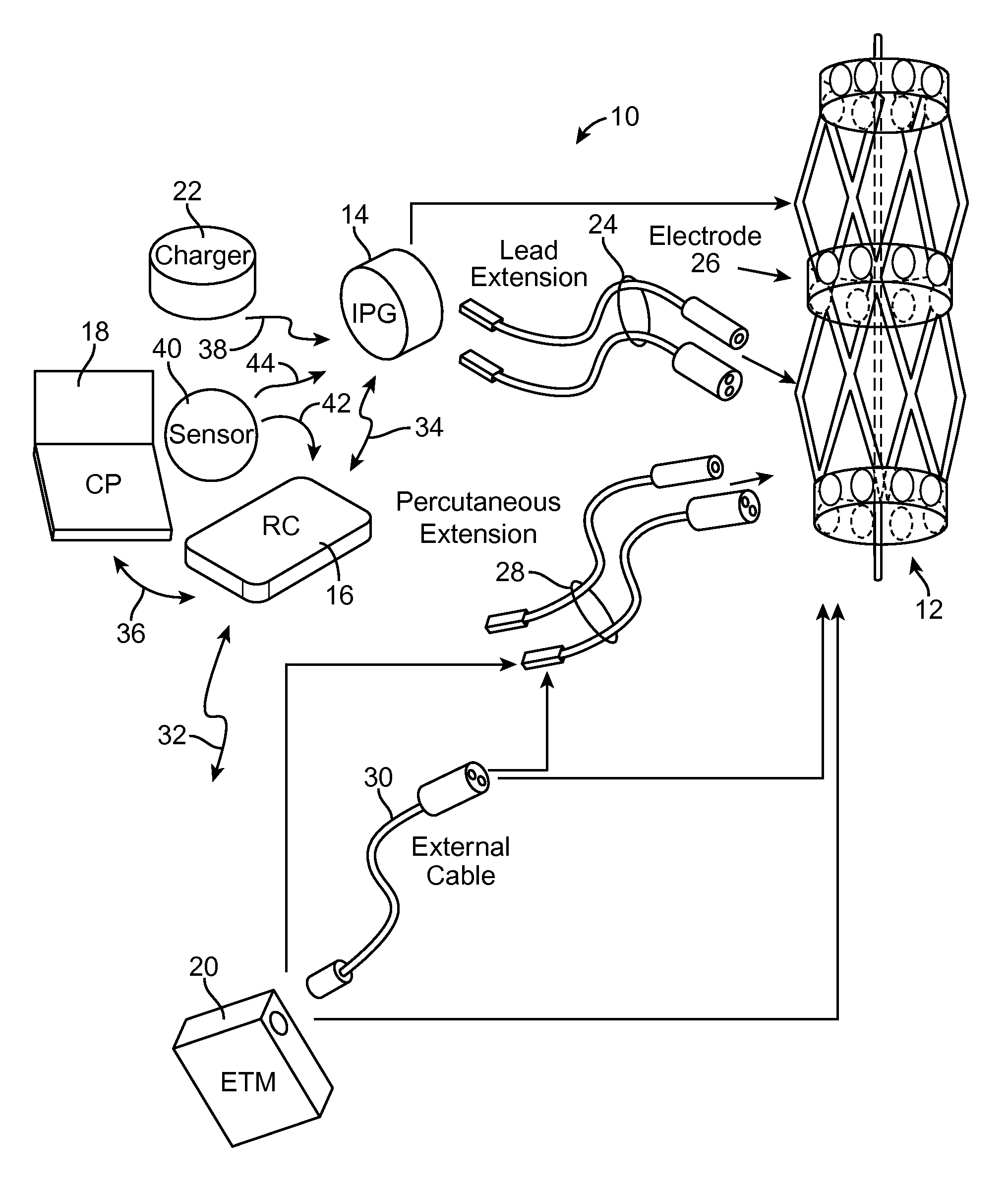 Neuromodulation of renal nerve for treatment of hypertension