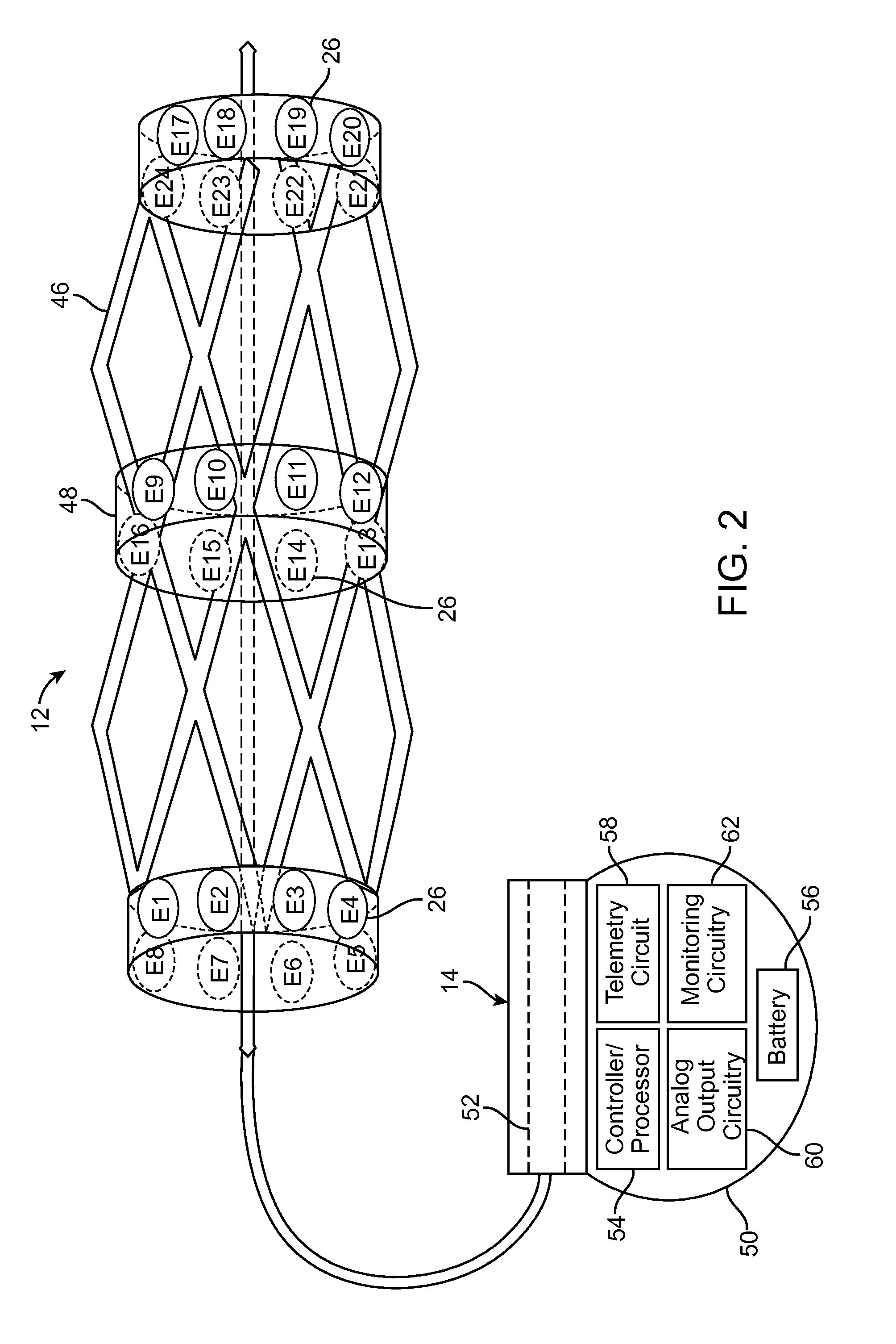 Neuromodulation of renal nerve for treatment of hypertension