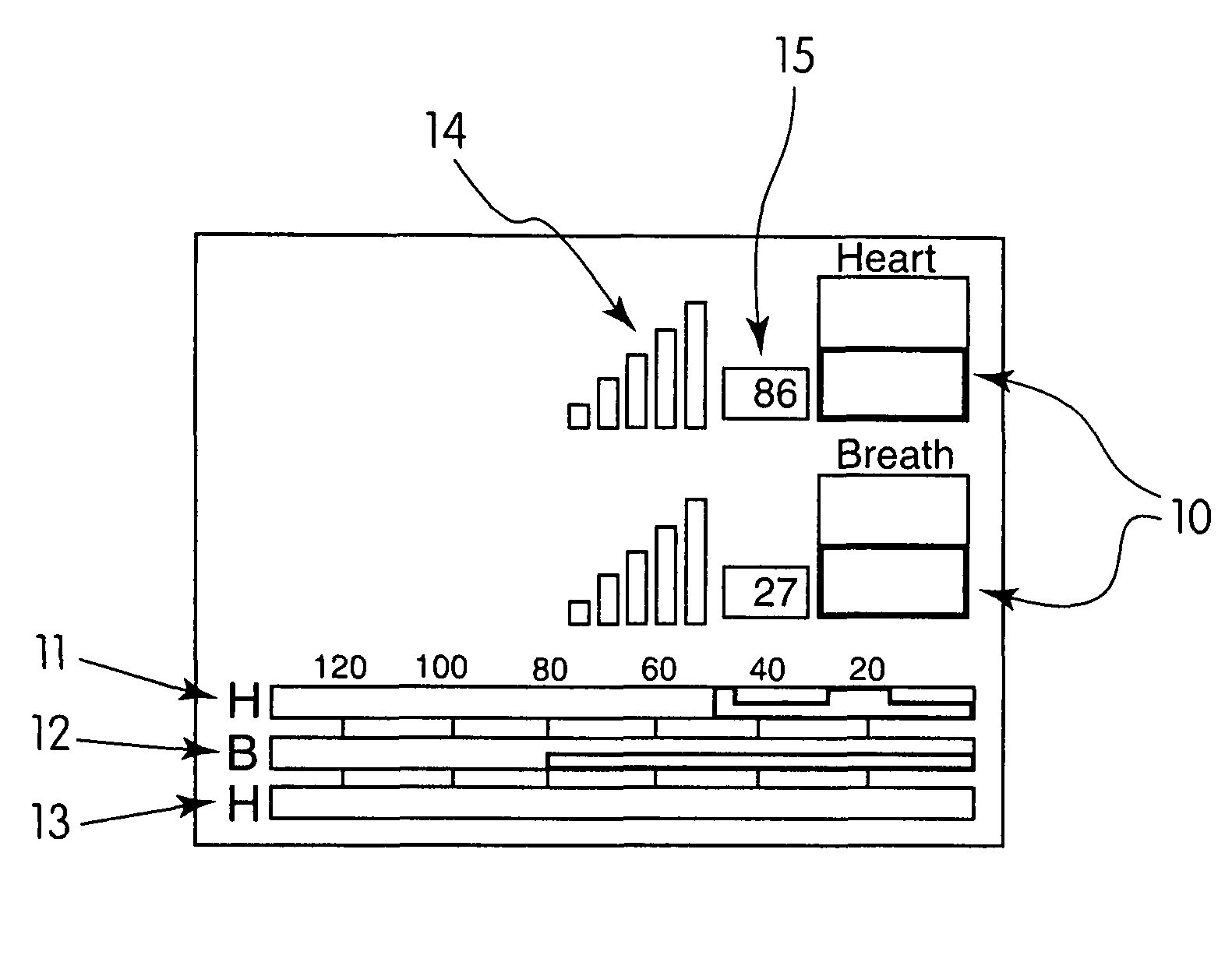 Handheld instrument capable of measuring heartbeat and breathing motion at a distance