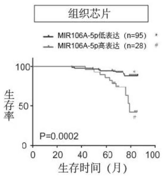 A biomarker for detecting the prognosis of nasopharyngeal carcinoma and its application