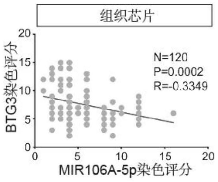 A biomarker for detecting the prognosis of nasopharyngeal carcinoma and its application