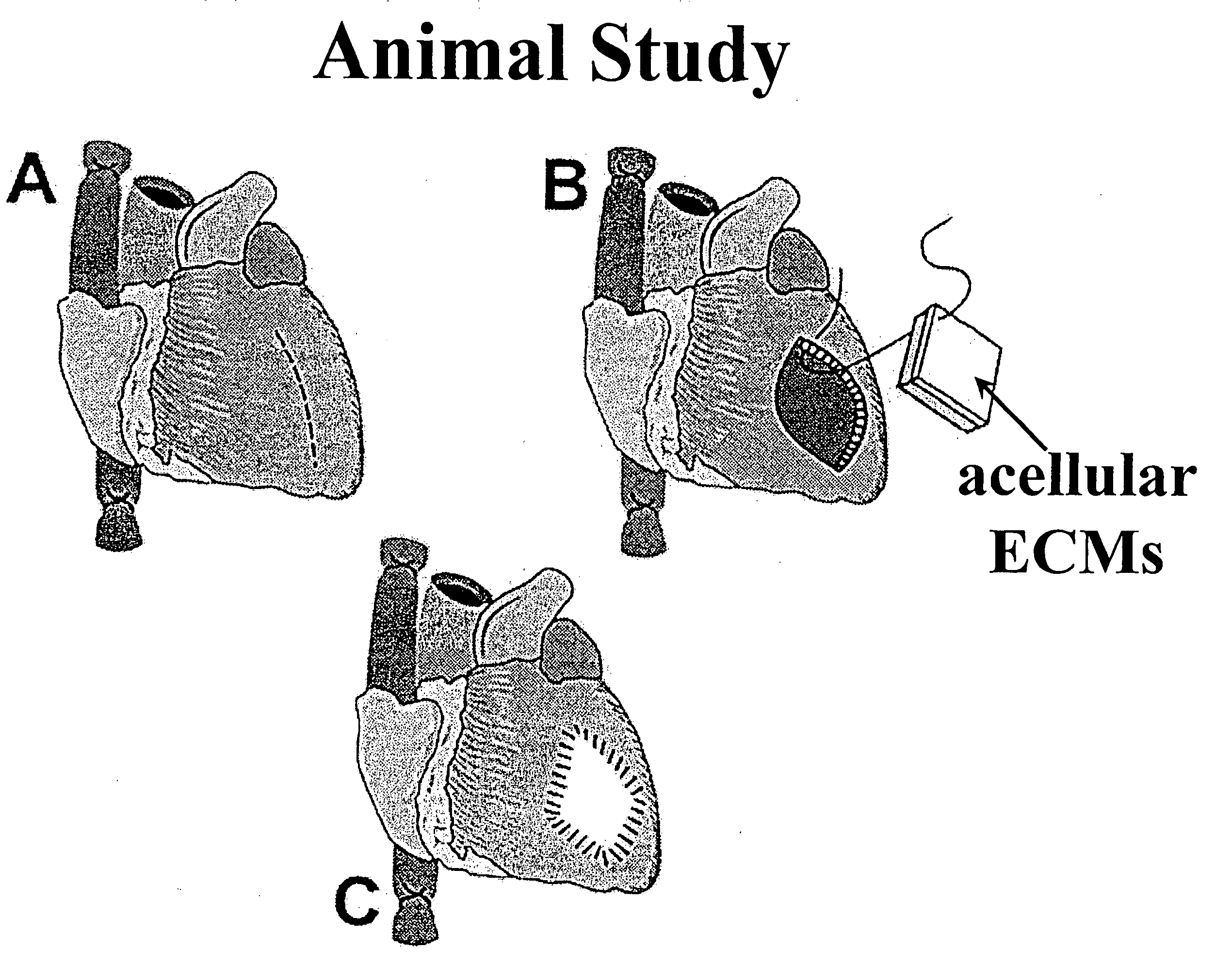 Peritoneal regeneration with acellular pericardial patch