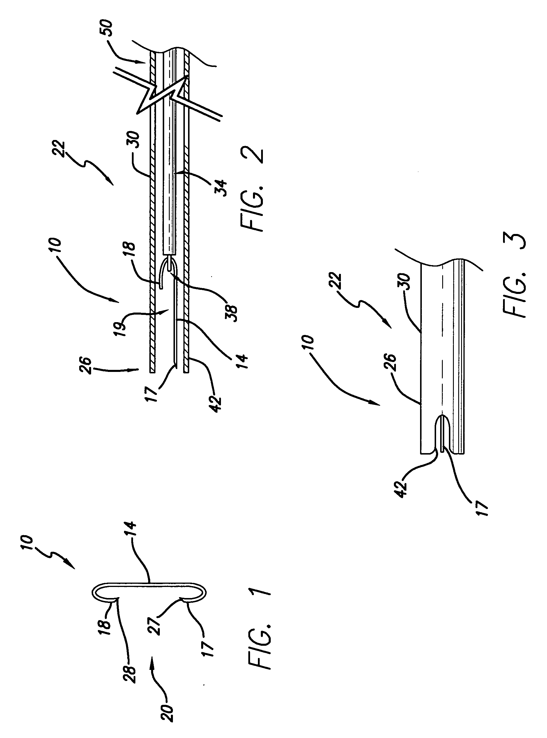 Medical stapler