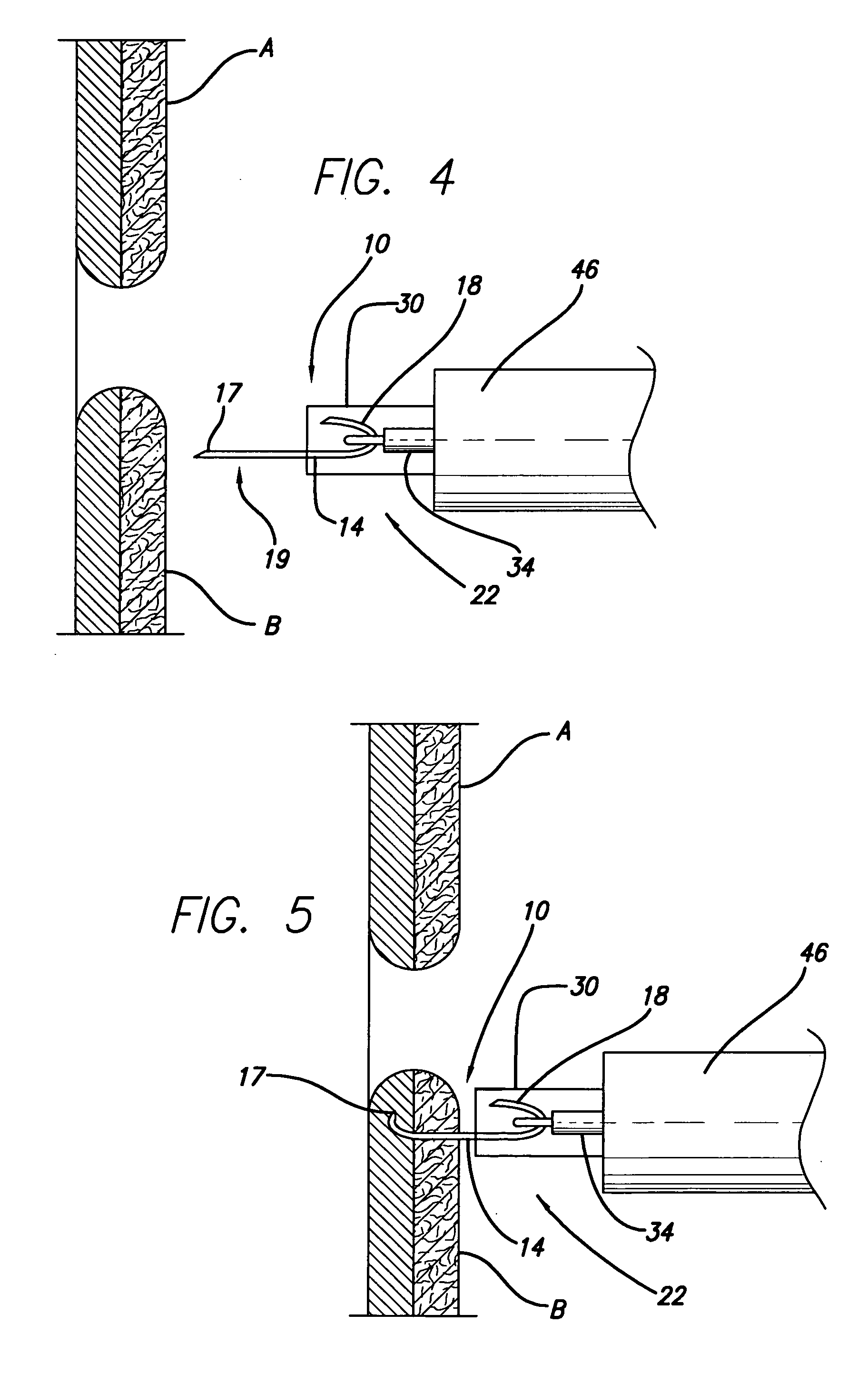 Medical stapler