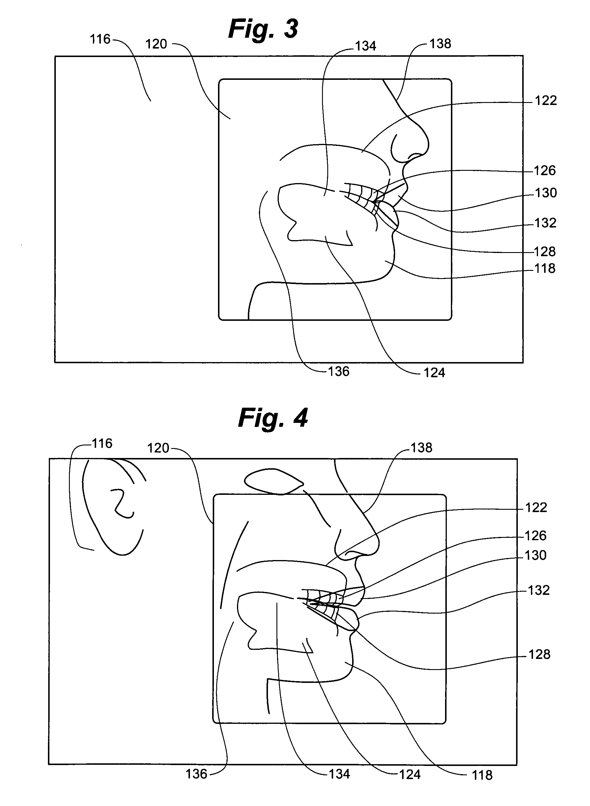 Speech instruction method and apparatus