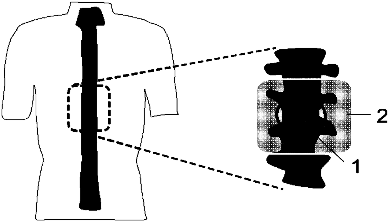 A kind of internal deep therapy instrument