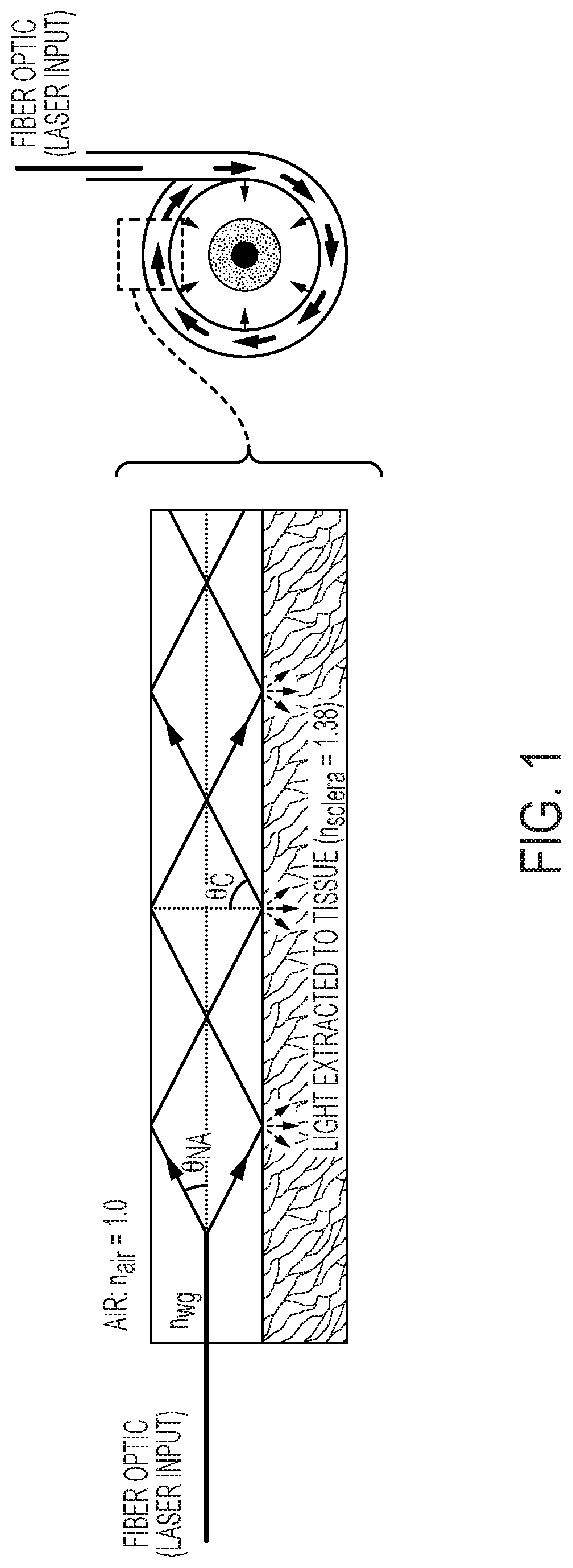 Systems, methods, and flexible optical waveguides for scleral crosslinking