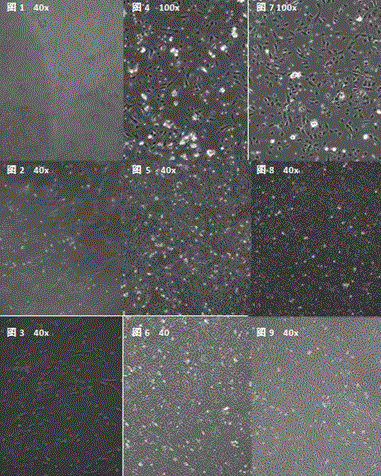 Isolated culture method of piglet myocardial fibroblasts