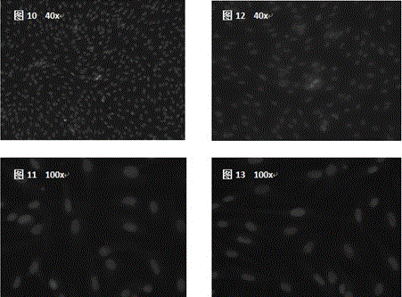 Isolated culture method of piglet myocardial fibroblasts