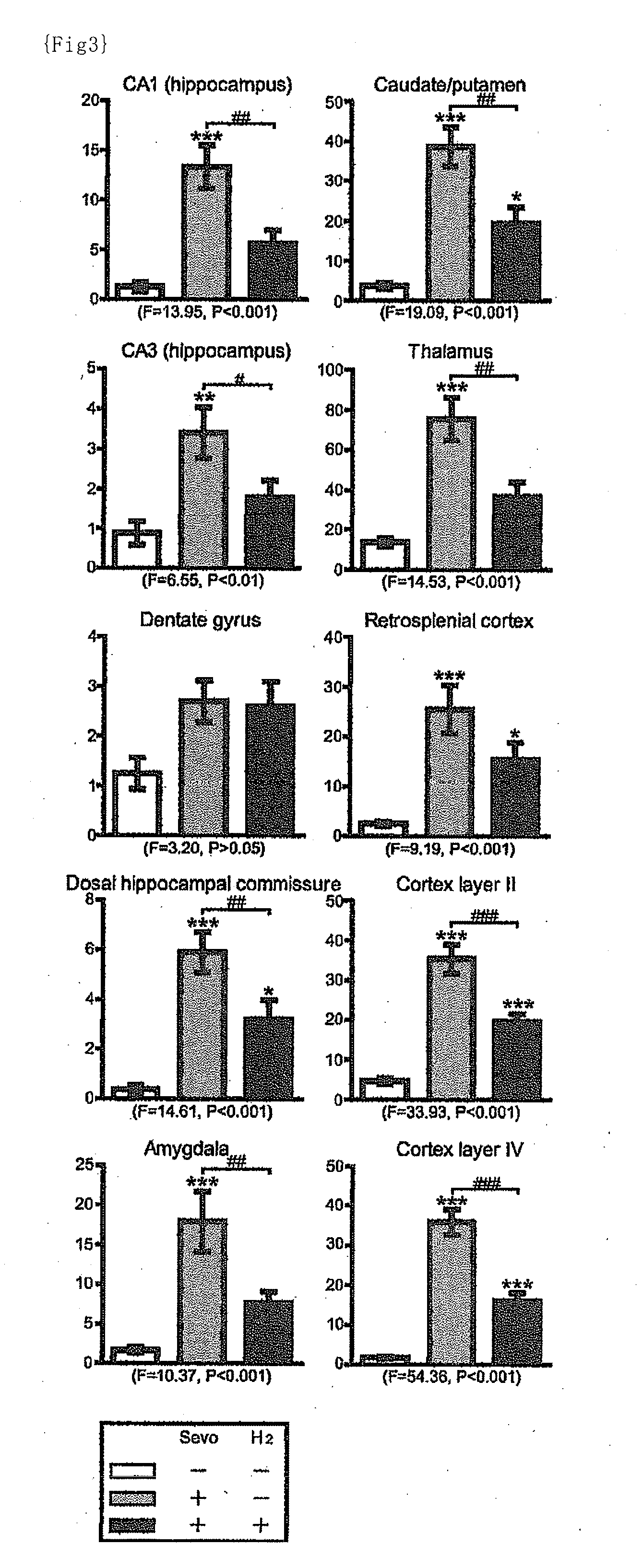 Medicine comprising combination of general anesthetic and hydrogen