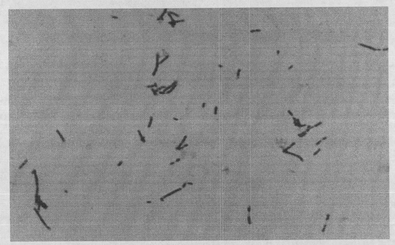 Application of tetra-carbonic acid or salt thereof to preparing 2-keto-L-gulonic acid in tricarboxylic acid cycle