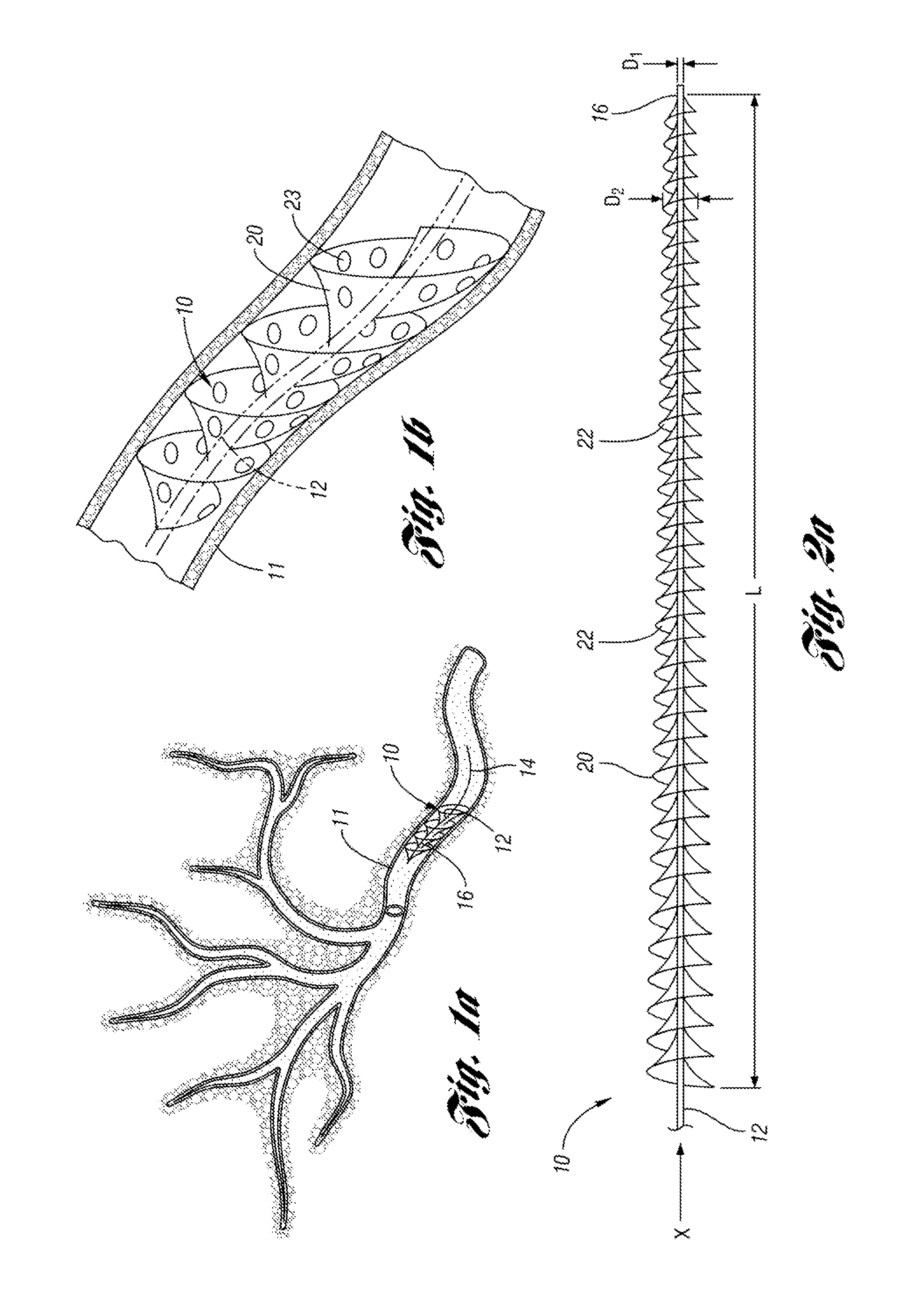 Helical embolic protection device